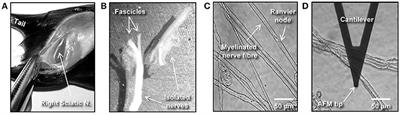 Nano-scale Biophysical and Structural Investigations on Intact and Neuropathic Nerve Fibers by Simultaneous Combination of Atomic Force and Confocal Microscopy